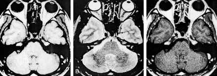 Fig 6.