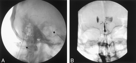 Fig 2.