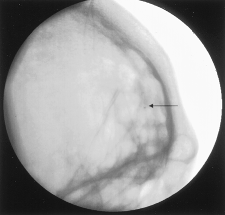 Fig 4.
