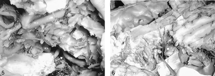 Fig 5.