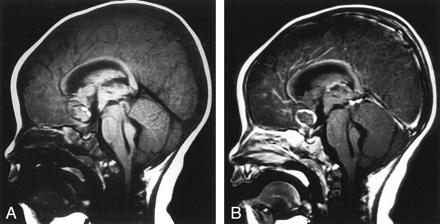 Fig 3.