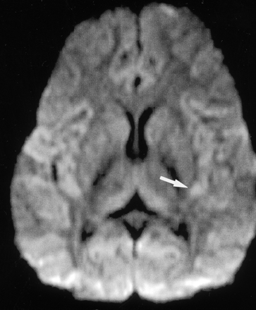 Fig 1.