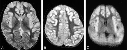 Fig 2.