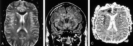 Fig 3.