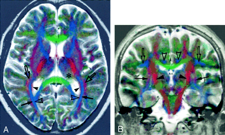 Fig 3.