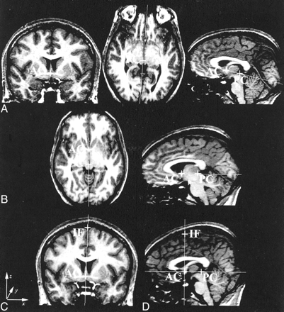 Fig 1.