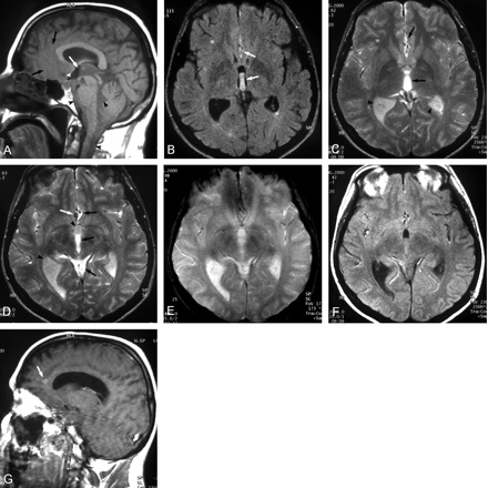 Fig 1.