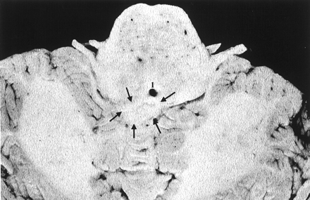 Fig 4.