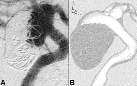 Fig 6.