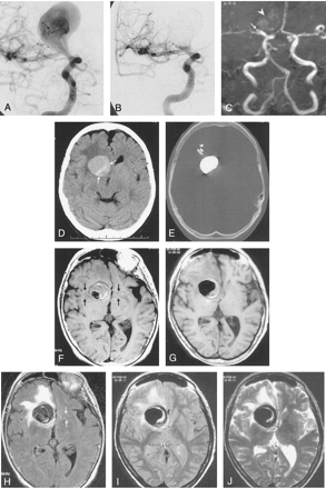 Fig 3.