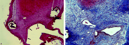 Fig 3.