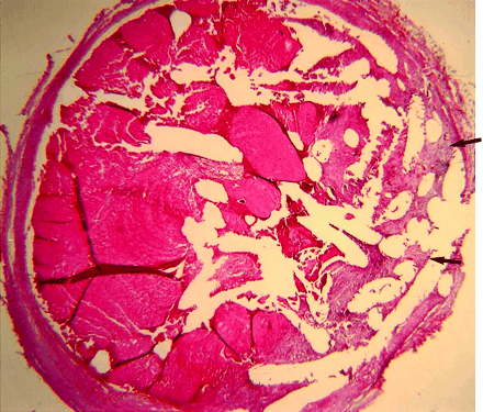 Fig 6.