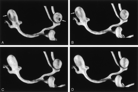 Fig 2.