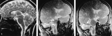Fig 2.