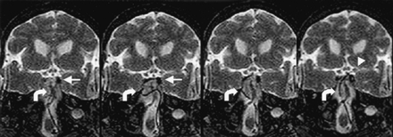 Fig 4.