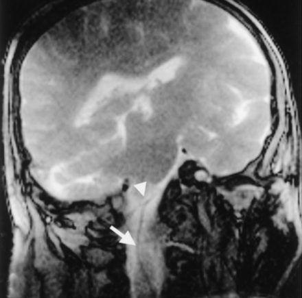 Fig 5.