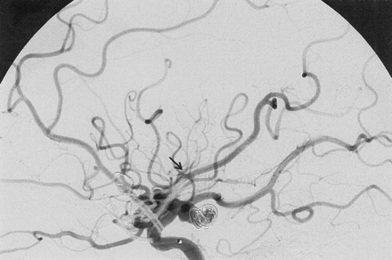 Fig 2.