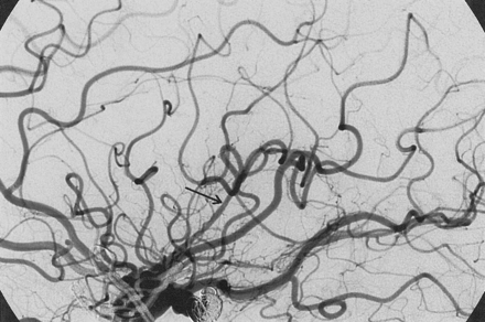 Fig 5.