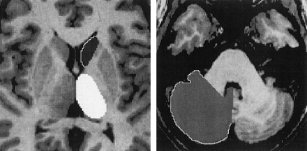 Fig 1.