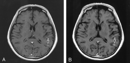 Fig 2.