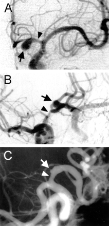 Fig 3.