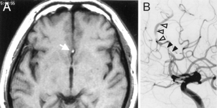 Fig 6.