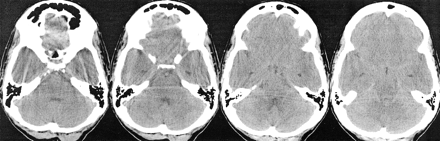 Fig 1.