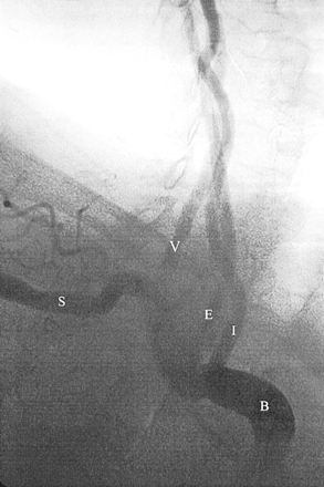 Fig 1.