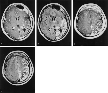 Fig 1.