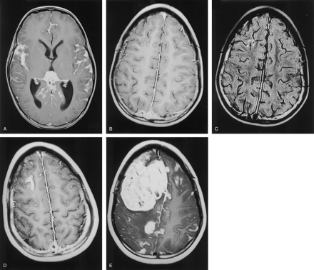 Fig 2.