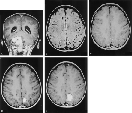 Fig 3.