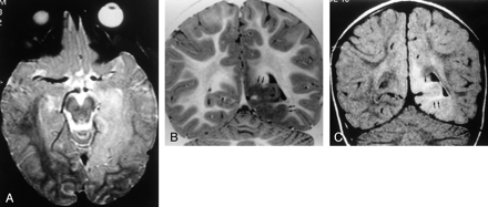 Fig 3.