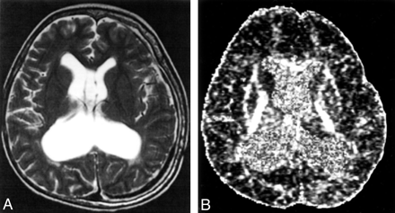 Fig 3.