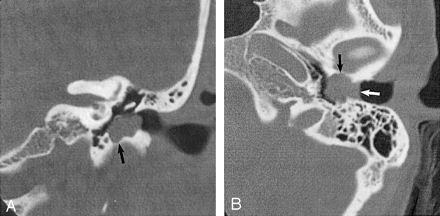Fig 1.