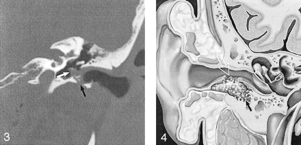 Fig 3.