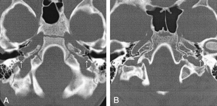 Fig 4.