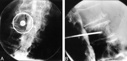 Fig 2.