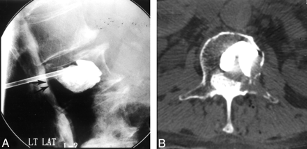 Fig 3.