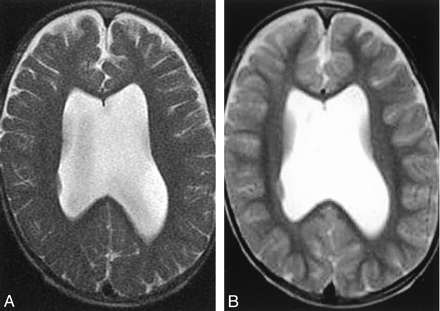 Fig 7.