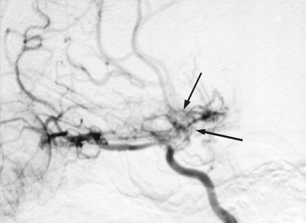 Fig 1.