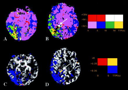Fig 4.
