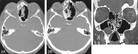 Fig 3.