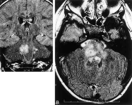 Fig 1.