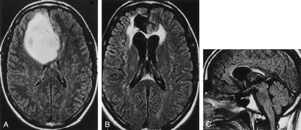 Fig 2.