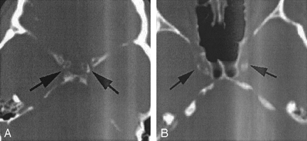 Fig 1.