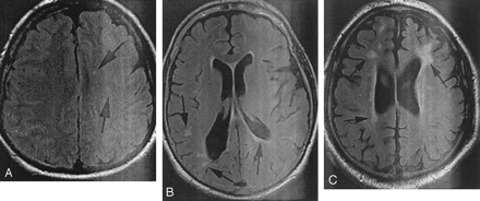 Fig 2.