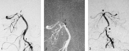 Fig 3.