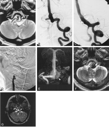 Fig 2.