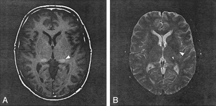 Fig 2.