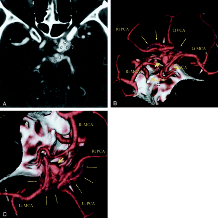 Fig 1.
